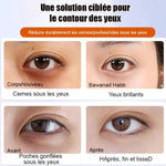 Charger l&#39;image dans la galerie, Sérum Contour des Yeux – Anti-Rides
