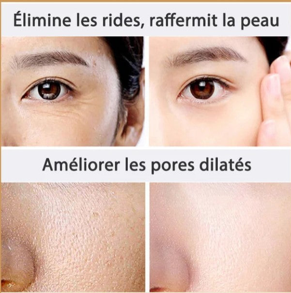 Crème blanchissante anti-rides