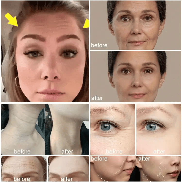 Crème Anti-Rides au Collagène Type III